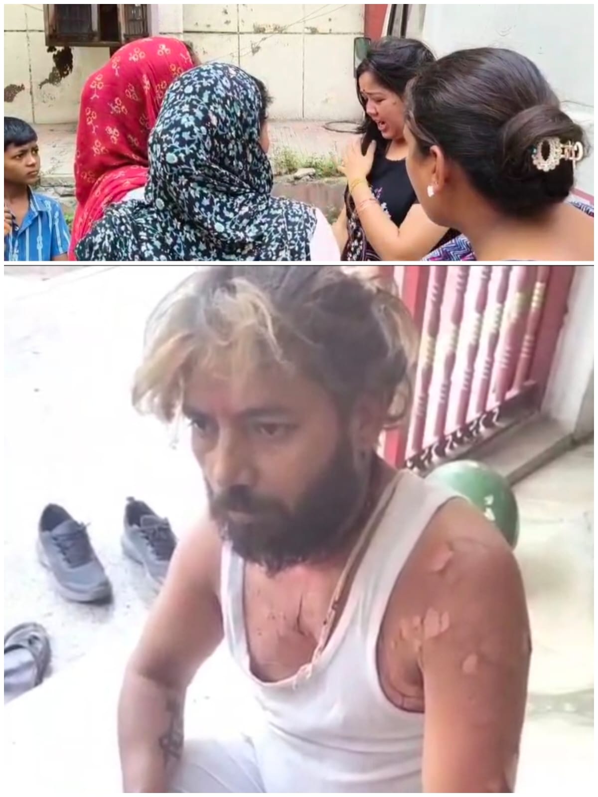 राधे कृष्ण मंदिर में कमेटी के साथ हुआ विवाद, पुजारी ने खुद को लगाई आग, हालत नाजुक